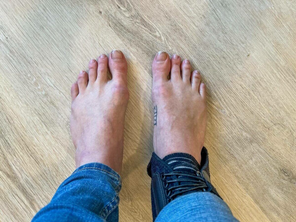 A view looking down at a pair of bare feet standing on a light hardwood floor, with a black ankle brace on the right foot.